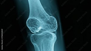 Human knee joint bone structure X ray medical science imaging