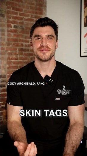 Skin Tags And Treatment Explained by a Dermatologist