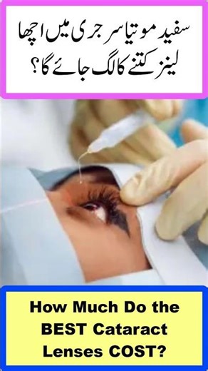 How Much Do the BEST Cataract Lenses COST? | #iol #blurredvision