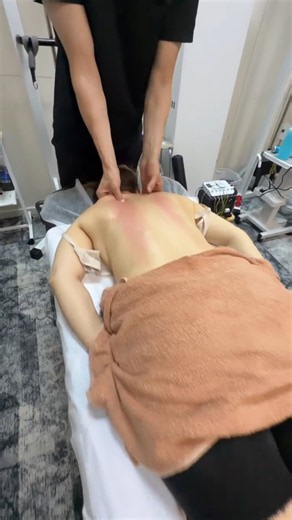 Satisfying Deep Tissue Upper Back Massage & Scraping Therapy