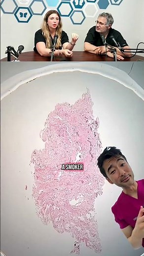 Popcorn Lung: The Hidden Danger of Vaping