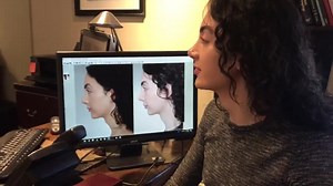 Laryngeal Shave Post-operative appointment