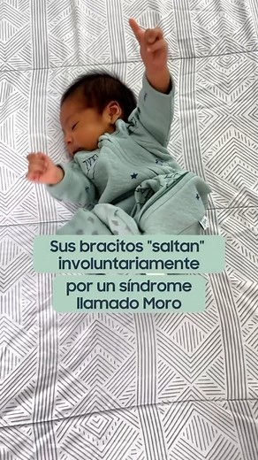 11K views · 1.1K reactions | El reflejo de Moro o de sobresalto, es...