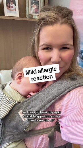 Understanding Anaphylaxis: Signs, Symptoms & What to Do | Dr. Katie