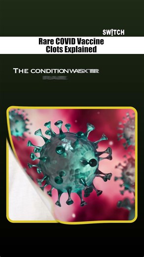 Rare Covid Vaccine Clots Explained