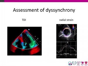 Philips CRT webinar version Kovacs v6