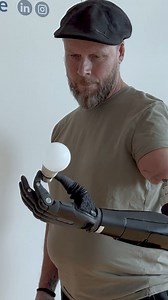 Wow, a bionic breakthrough! 料 This is Tonney, he has the world’s...