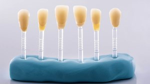 Cosmetic Dentist Jacksonville, FL | Teeth Whitening | Veneers