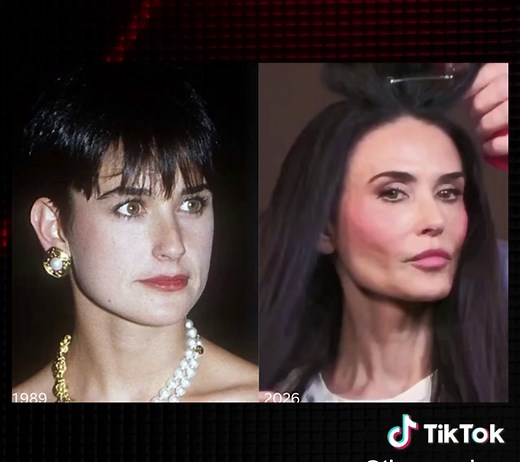 Demi Moore’s botched plastic surgery has a “horrifying” result. #thenerveshow #news #popculture