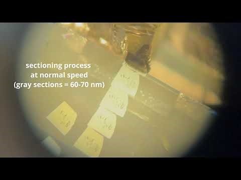 Ultrathin sectioning for transmission electron microscopy (TEM)
