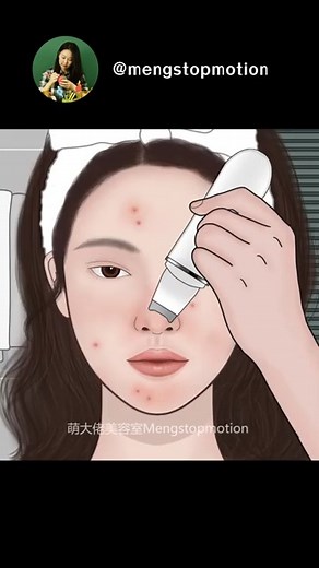 Oddly Satisfying ASMR Animation_ Pimple Popping Blackhead Removal ✨ Night Skincare Routine #asmr | Meng's Stop Motion