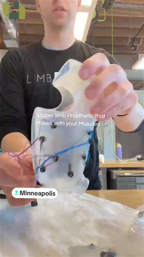 Minneapolis builds your transradial prosthetic! 🤩 Jake is creating this myoelectric below-elbow prosthetic, combining precision, style, and cutting-edge arm technology 🦾 Custom upper limb prosthetic solutions built just for you. Let’s create your personalized artificial limb together! Click the link in our bio or the Contact Us button.# #Prosthetics #Minneapolis #MyoelectricTechnology #TransradialProsthetic #UpperLimbProsthetic CustomProsthetics | MinneapolisProstheticArm | ProstheticArm | Art