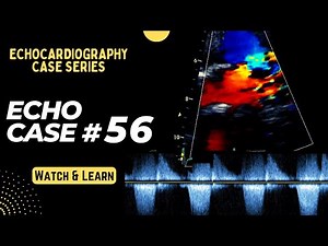 Echo Case 56: Echocardiography Spot Diagnosis Series | Cardiology | Educational Video