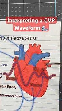 How to Interpret a CVP Waveform #nursingstudent #studytips #icueducation #nursingschool #nurselife