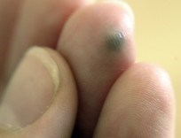 Implanting a magnet in your fingertip adds a sixth sense
