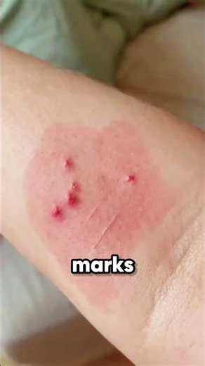 You might think it’s just a mosquito… watch this 😨 #shorts