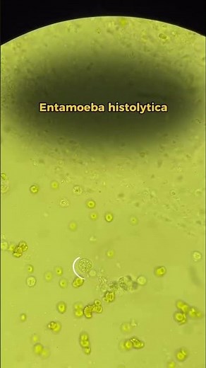 Entamoeba histolytica. // is a parasitic protozoan that causes amoebiasis.