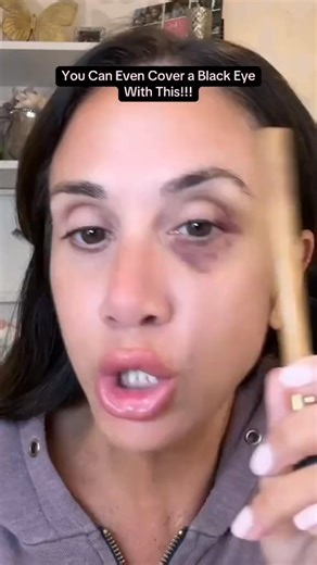 “Bye Dark Circles ✨ Hello Radiant Eyes” Meet the Colored Clay Undereye Corrector — your all-in-one undereye solution. ✅ Instantly evens skin tone ✅ Reduces the look of wrinkles & fine lines ✅ Full coverage with a radiant, crease-free finish ✅ Moisturizing, waterproof & dermatologist tested 🎁 Plus: Free gift brush with every order (while supplies last). 💖 Bright, smooth, wide-awake eyes start here. | Gadget Fix for Homes