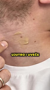 Evo kako se bračni par Jurišić riješio bradavica efikasno 🔥 ✅Mažeš na bradavicu i počinju da se suše ✅Efekti već posle 2 sedmice Ne čekaj nego poruči odmah dok traje popust! 🤞 | Dermotin