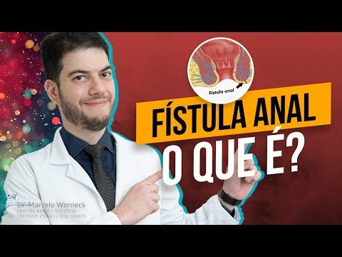 Fístula Anal - O que é?