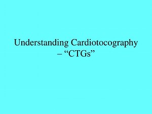 Understanding Cardiotocography – “CTGs” - SlideServe