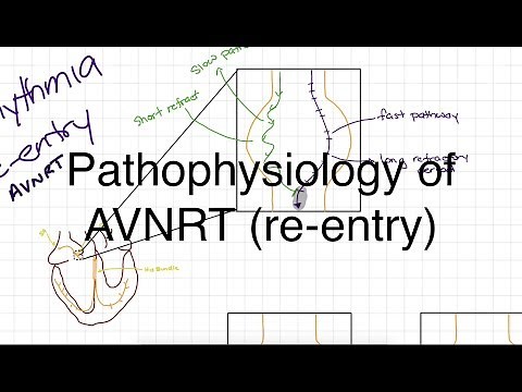 Pathophysiology of AVNRT
