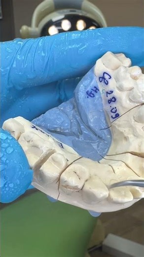 Dental Crown Prep on Model | Close-Up 4. How Dentists Practice Tooth Preparation #dentalclinic