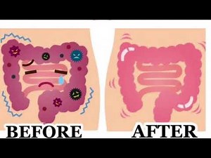 Oxy Cleanse Colon Detox and Cleanser