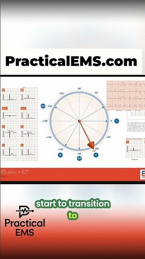 ECG R-Wave Progression: Master Normal Heartbeat Patterns #shorts