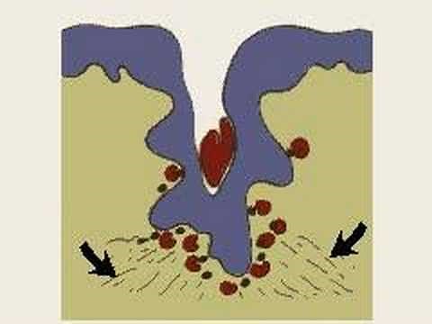 How the Body Works : When the Skin is Cut
