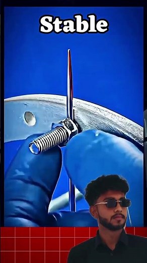 Leg bone fracture #bone surgery #orthopedic surgery #