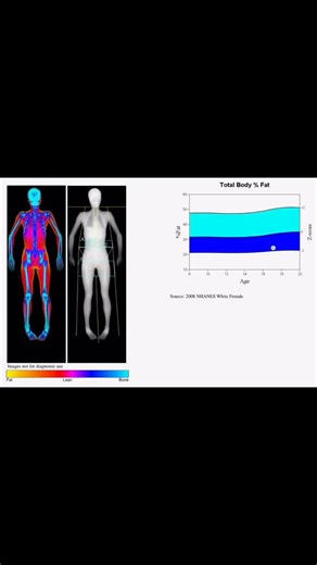 Elsa | Nutrition + Biohacks on Instagram: "👉In 2019, my body weight was 106.3 pounds. My body fat percentage was 24.4 percent. That translated to approximately 26 pounds of fat mass and 76.5 pounds of lean mass. My BMI at that time was 18.8, which falls within the “normal” range. My resting metabolic rate was estimated at 1,156 calories per day. In my most recent DEXA scan, my body weight is higher at 113.2 pounds. My body fat percentage is lower at 21.1 percent. My fat mass is now approximatel