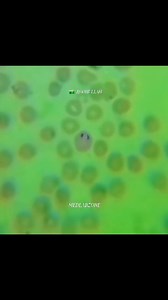 11K views · 39 reactions | Malarial Parasite Under Microscope  #highlightsシ゚ #foryoupagereels #viralreelsfb #newviralreelsvideo #viralreelsfacebook #viralreelschallenge #fluidexamination #tiktokviral #views1m #instagramreels #malaria #microscope #mlt #todaybestvideo #viralvideo #viralreels #parasitology #microscopy #tiktokviral #viralreelsfb @topfans MED LAB ZONE Abdul Halim SaMrr Alii RoseApple Darathorn | MED LAB ZONE | Facebook