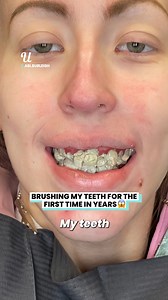 3.6M views · 5.3K reactions | They kept breaking every time I tried  | Ultimate | Facebook