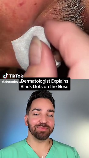 Pores When it comes to sebaceous filaments, you know my go to is gonna be @Remedy Science for Pore Size but all black dots on the nose are equal Tiny vellus hairs need to be tweezed or use pore strips / wax the nose once a month