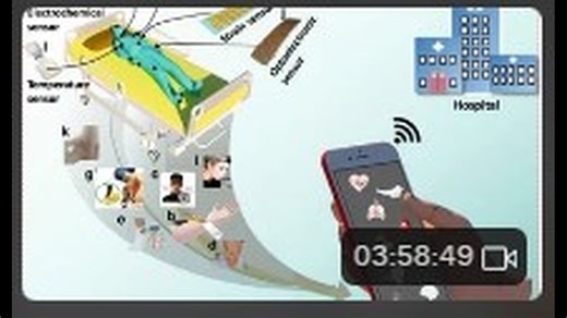 Neural Dust and standing waves deep in the skull