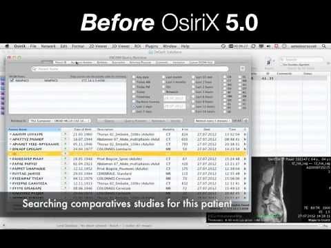 OsiriX PACS On-Demand