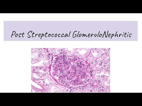 Post Streptococcal Glomerulonephritis( PSGN)