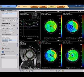 查看 Philips Cardiac Explorer心脏管理器 磁共振工作流程解决方案 HCOPT01 的详细信息