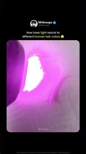 Hair Color Changes How Laser Energy Is Absorbed 😮