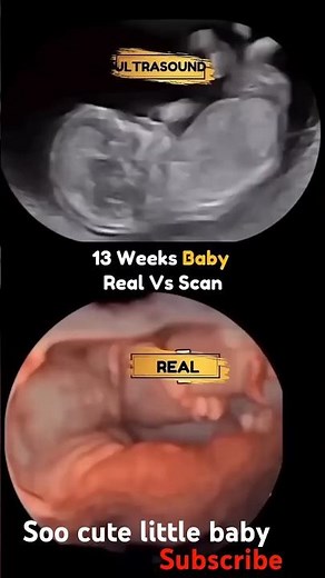 real video vs ultrasound scan video of 13 week baby
