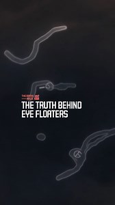 938K views · 9.1K reactions | The Truth Behind Eye Floaters - What are those drifting shadows in your vision and why do so many people see them, according to studies and a TED Ed explanation? Discover the hidden movements inside your eyes and what they might reveal. | The Brain Maze | Facebook