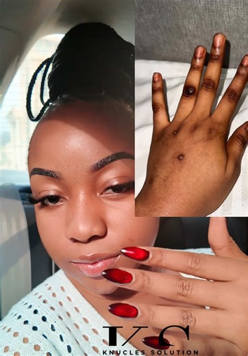 Get Your Solution Kit for Just 15,000