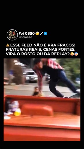 Foi OSSO 🤕🦴 on Instagram: "CLIQUE EM SEGUIR 👆 👆 👆 🦴 Sabia que? Ossos quebrados demoram de 6 a 12 semanas para cicatrizar O tempo de cicatrização depende do tipo de fratura, da idade e da saúde geral da pessoa. Crianças geralmente se recuperam mais rápido que adultos. Durante esse período, o osso passa por três fases: inflamação, formação de calo ósseo e remodelação. É importante seguir orientações médicas, evitar esforço excessivo e ter alimentação rica em cálcio e vitamina D para ajudar n