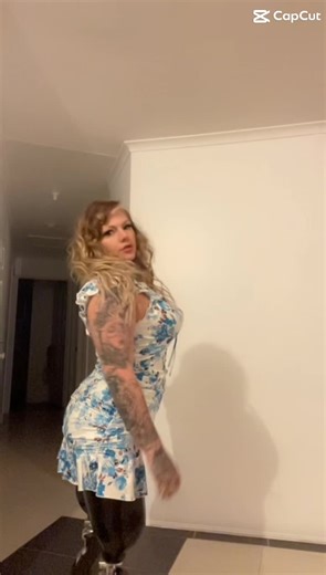 Bionic Beauty: The Life of an Amputee Girl