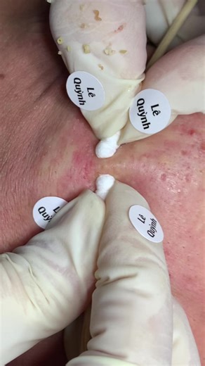 Khách c#chamsocdaseo#chamsocda#chamsocdamun#chamsocdanam#tanbinh