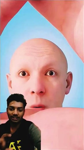 What Should You Do If Your Eyes Are Weak? 👀😱🔥