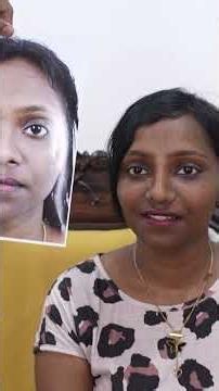 South Indian Girl Rhinoplasty Surgery
