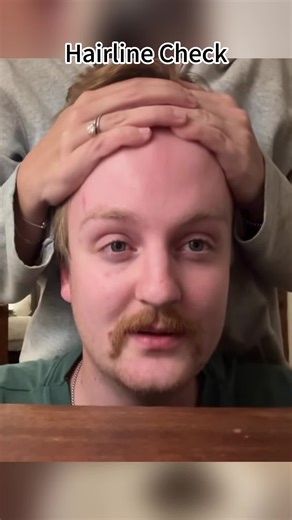 Hilarious Hairline Check Prank