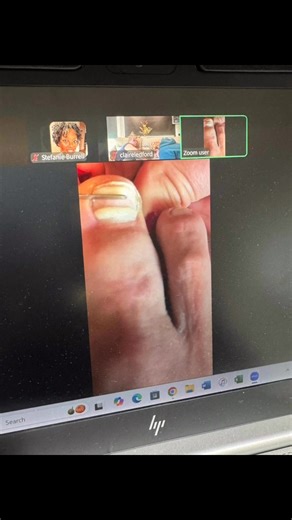 When class is in session the teacher will appear. Two more certified Onyfix professionals added to the community. Available for licensed nail techs, medical offices and podiatry offices. Let’s get you certified. Virtual or in person training available. | FeetMatters MediNail Spa | Facebook
